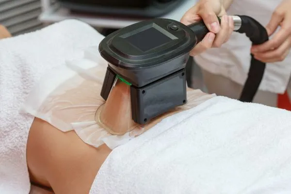 Image of person having fat freezing treatment to help weight gain City of London