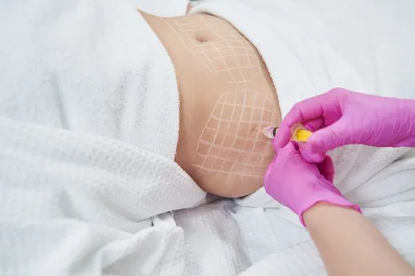 image of fat dissolving injections on love handles to help combat weight gain City of London
